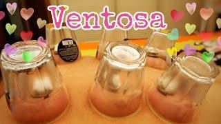 How to Ventosa at Home | Cupping Therapy | Ventosa Procedure