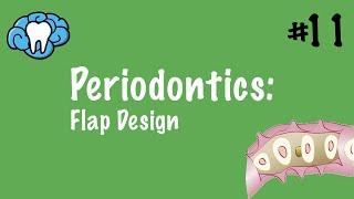 Periodontics | Flap Design | INBDE, ADAT