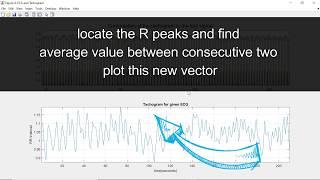 Locating exact position of Q, R, S, T points in ECG signal | MATLAB | How to plot a tachogram