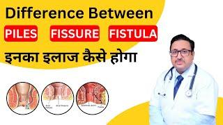 Difference between piles, fissure and fistula पाइल्स, फिशर और फिस्टुला में अंतर #youtube #agra