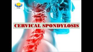 THE BEST CERVICAL SPONDYLOSIS TREATMENT IN IPOH