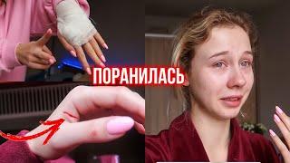 Поранила руку жестяной банкой  Что за чёрная полоса? Боюсь зашивать 