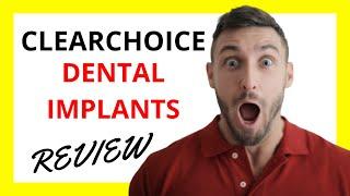  ClearChoice Dental Implants Review: Pros and Cons