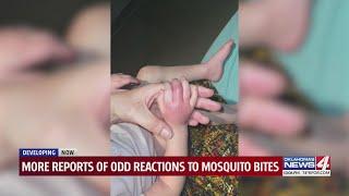 More reports of odd reactions to mosquito bites