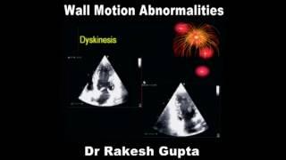 Wall Motion Abnormalities Dr Rakesh Gupta