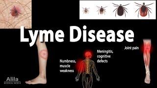 Lyme Disease, Animation