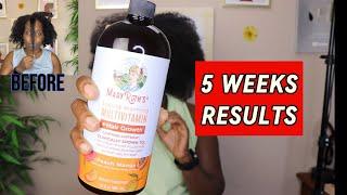 My Results with Mary Ruth's Multivitamin and Batana Oil 5 Weeks, My Hair Growth