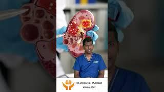 Kidney stone treatment in Tamil | kidney stones Tamil Treatment | சிறுநீரக கற்களால் அவதியா