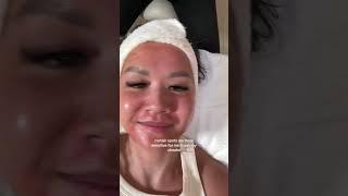 Come Get Microneedling with Me! #microneedling #skintreatment #antiaging