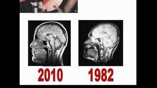 MRI Basics 1 (شرح الرنين المغناطيسي )