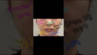 뀨없이 인중 짧아지는 입술필러 #입술필러가로길이 #몬스터의원
