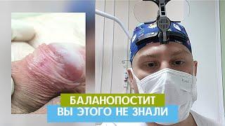 Баланопостит | Постоянно воспаляется головка | Обрезание