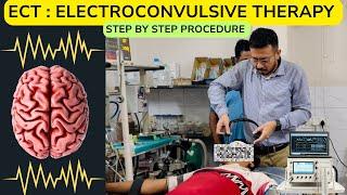 ECT : Electroconvulsive Therapy Real Video। मानसिक बीमारियों के लिए ब्रह्मास्त्र !