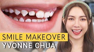 INCREDIBLE Smile Makeover! | Dr Kayla Dental Clinic #YvonneChua