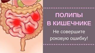 Полипы В Кишечнике. Нашли полипы при колоноскопии. Как не совершить ошибку