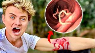 Deadly Worms ATTACKED Me!