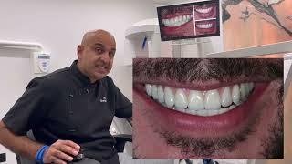 From hereditary periodontal disease to a full mouth rehabilitation