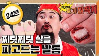 찌릿찌릿 살을 파고드는 발톱｜최고다! 호기심 딱지｜[EBS놀이터]