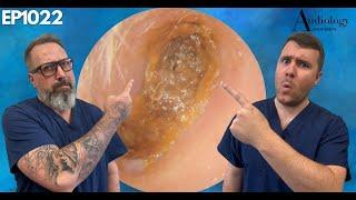 Ear Wax Removal, Skin & Glue: The Weird World of Ears - EP1022