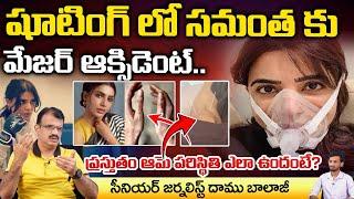 Samantha Admitted In Hospital, Shocking Twist In Medical Reports ? | Daamu Balaji Diaries