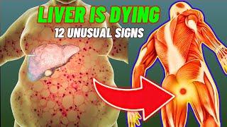 LIVER Damage ALERT! 12 Silent Signs You're Ignoring ||@Immune Savvy