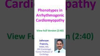 Phenotypes in Arrhythmogenic Cardiomyopathy