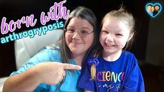 Born with Arthrogryposis - AMC Awareness Day 3