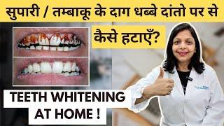 How to whiten teeth at home, TEETH WHITENING तंबाकू.गुटखा के दाग कैसे हटाये( घरेलू उपाय)?