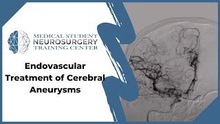 Endovascular treatment of Cerebral Aneurysms