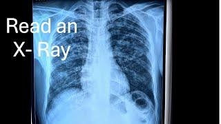 Read an XRay :  part 1 For medical students