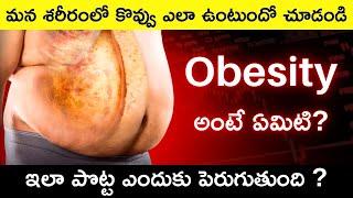 Obesity Explained in Telugu | What is Obesity and Causes & Tips for Weight Loss in Telugu Badi