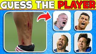 Guess Football Player by his INJURY and RED CARD ️‍🩹 Football Quiz about Ronaldo, Messi, Neymar