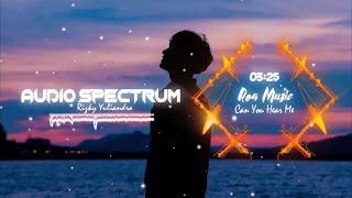 Can You Hear Me - Roa X Riz - Music Visualizers [Music Time]