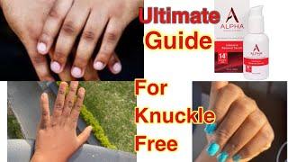 HOW TO GET RID OF KNUCKLES | THE ULTIMATE GUIDE YOU NEED #skincare