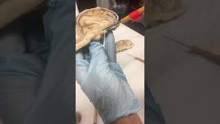 Anatomy 125 Dr Madden Spring 17