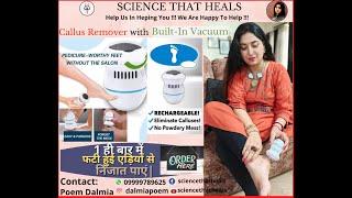 Callus Removal with built-in vacuum | dead skin removal | hindi | DIY | Daily remedy