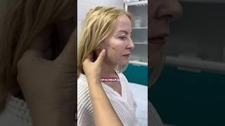Что не зависит от хирурга и от пациента? До конца Пластический хирург НИКОЛАЕВА САНДАРА