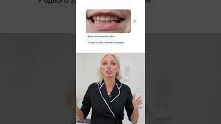 Разбор новой улыбки