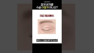 쌍꺼풀 수술, 절개 어떻게 진행 되나요? #쏘울성형외과 #의정부성형외과 #쌍꺼풀수술 #성형외과 #절개쌍꺼풀 #매몰쌍꺼풀수술