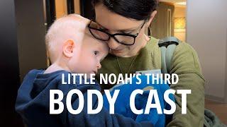 Family of 14 Prepares for Mom & Dad to Take Son to Get His Third Body Cast