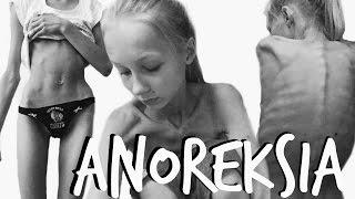 MÄ JA ANOREKSIA  | storytime | kuvia