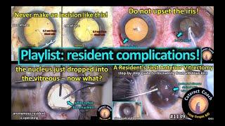 CataractCoach 1139: playlist: resident complications in cataract surgery