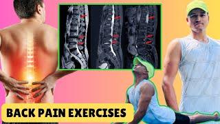 Back Pain Stretching Exercises : पीठ और कमर दर्द के लिए शानदार तरीका ! ‍️