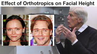 Is Orthotropics Treatment Able to Affect the Length of the Face by Prof John Mew