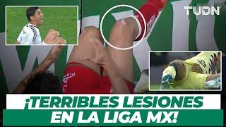 ¡Las más dolorosas! Top de lesiones ESPELUZNANTES en la Liga Mx | TUDN