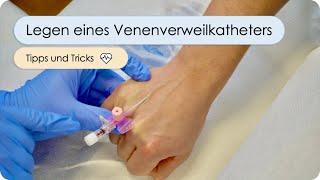 Legen eines Venenverweilskatheters - Schritt für Schritt (i.v. Zugang legen, Viggo, PVK, VVK)