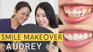 SHOCKING Smile Makeover! | Dr Kayla Dental Clinic #Audrey