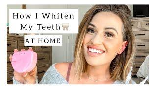 HOW I WHITEN MY TEETH  AT HOME |dental assistant | LEANNA MICHELLE