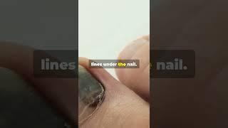 9 Health Warning Signs from Your Nails! 