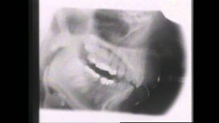 Kevin Munhall Xray Database 3